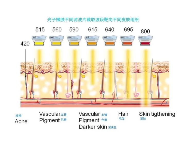 五大光子嫩膚技術(shù)（IPL、DPL、OPT、APT、BBL）及濾光片區(qū)別